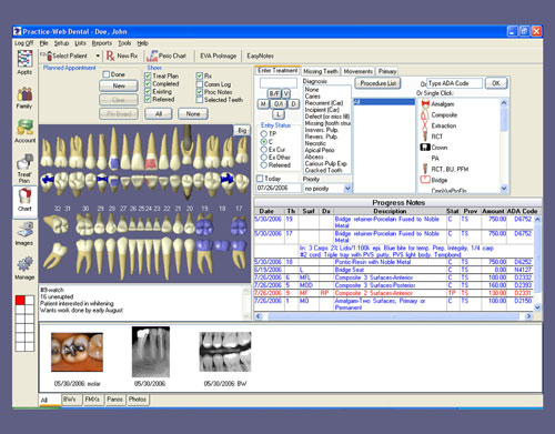 Dental Charting Practice Examples