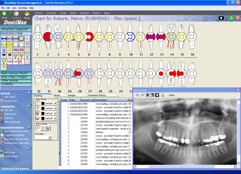 Softdent Charting